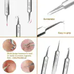Fecong™ Stainless Steel Blackhead Removal Kit