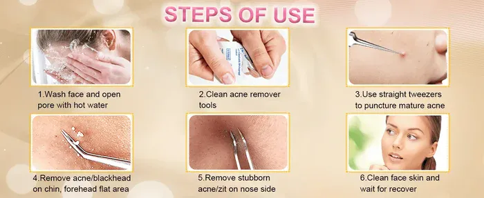 Usage steps
